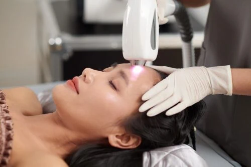 CO2 Laser Resurfacing in Los Angeles and Malibu